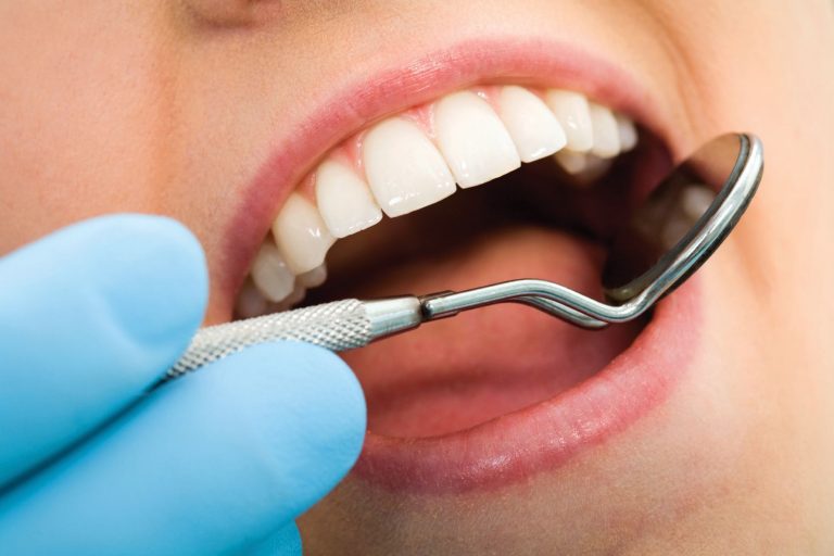 Implant dentaire : Comment elle fonctionne la dent ?